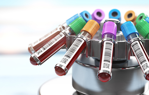 Blood test tubes in centrifuge. Plasma preparation in medical  hematology laboratory concept. 3d illustration