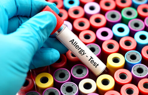 Allergy test